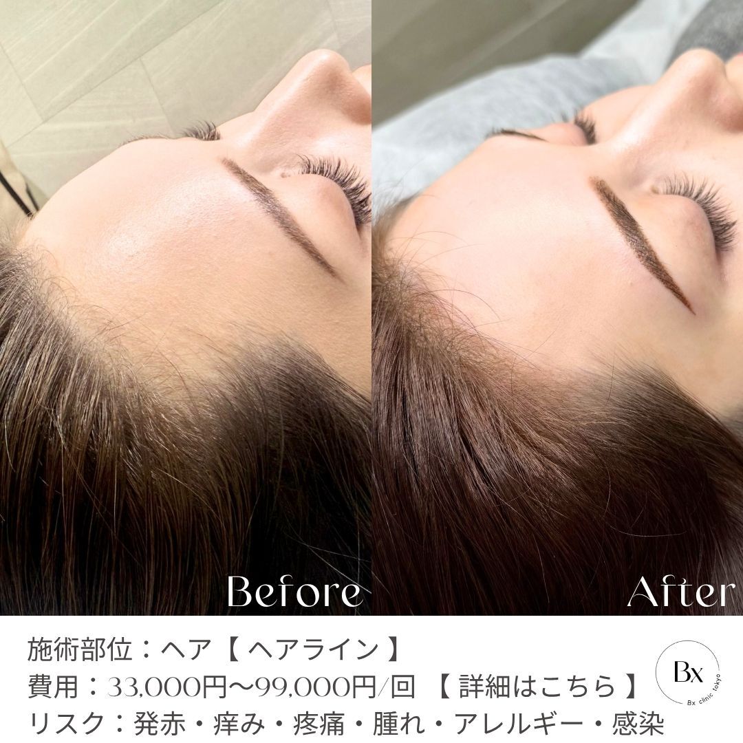 multi_image