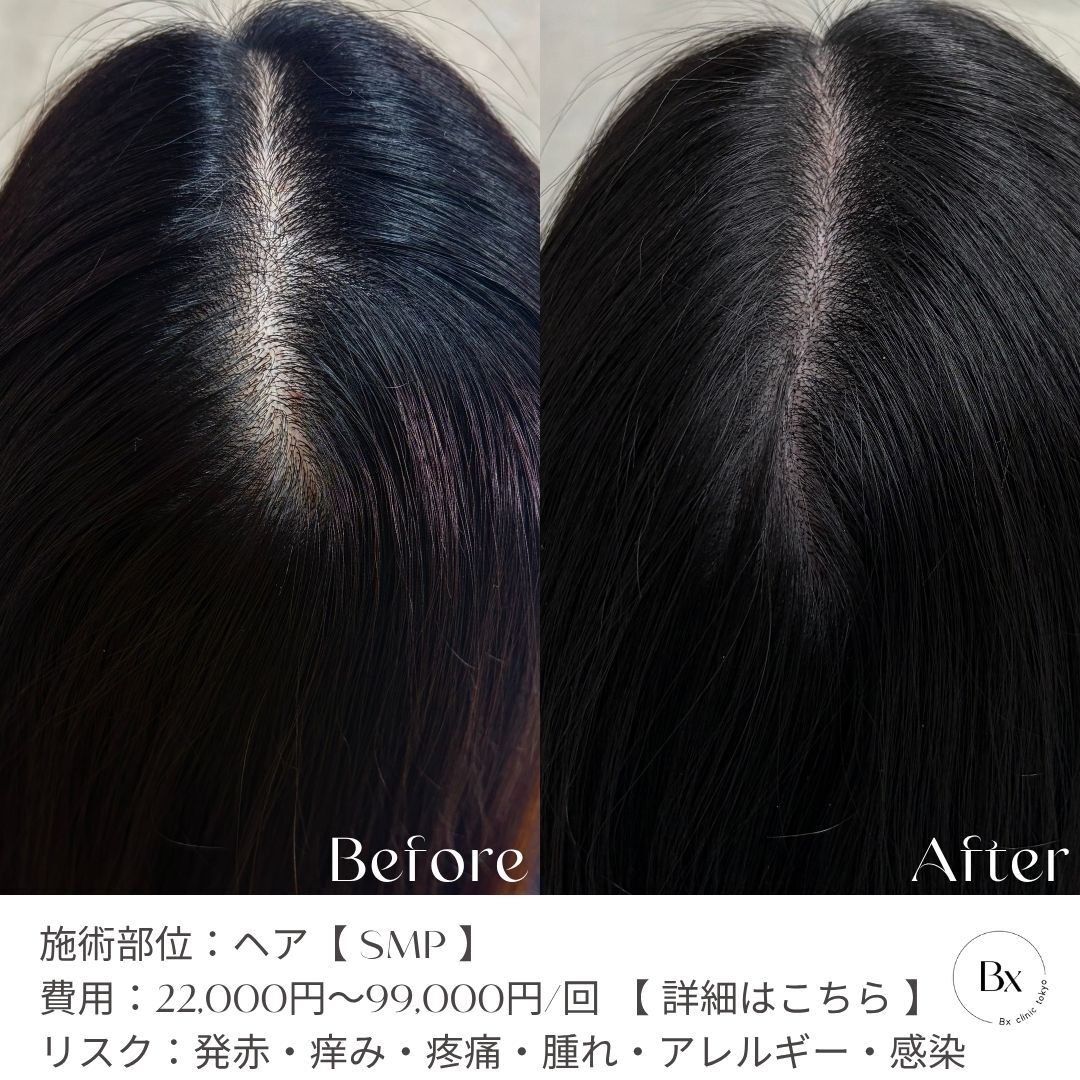 multi_image