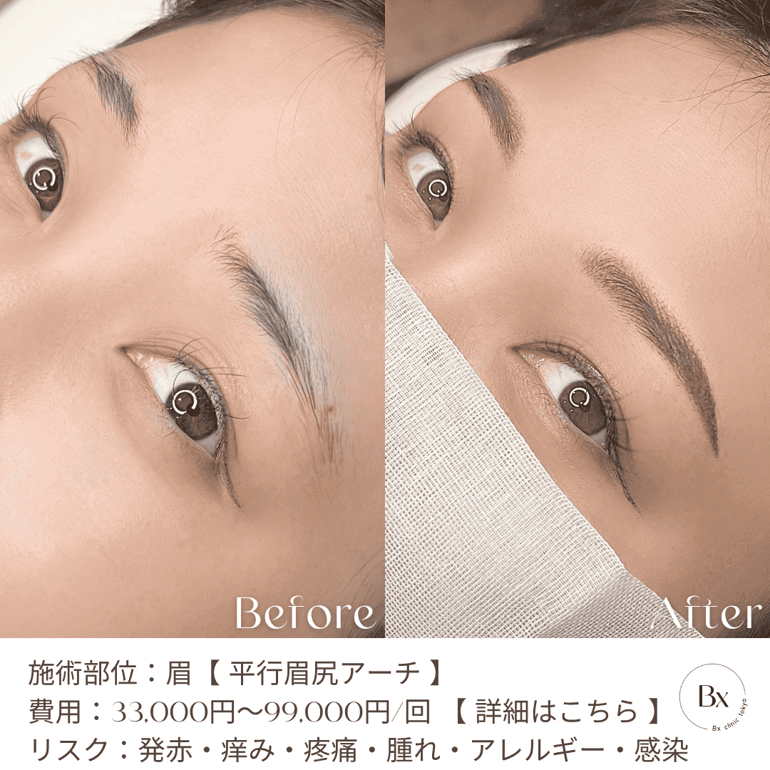 multi_image