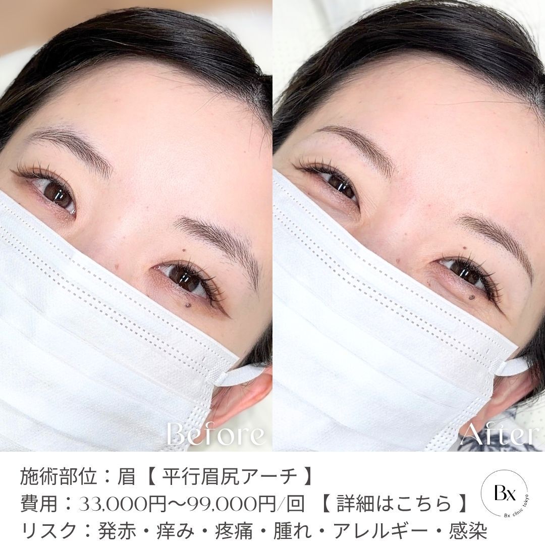 multi_image