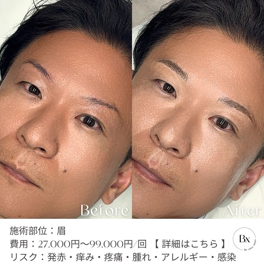 multi_image