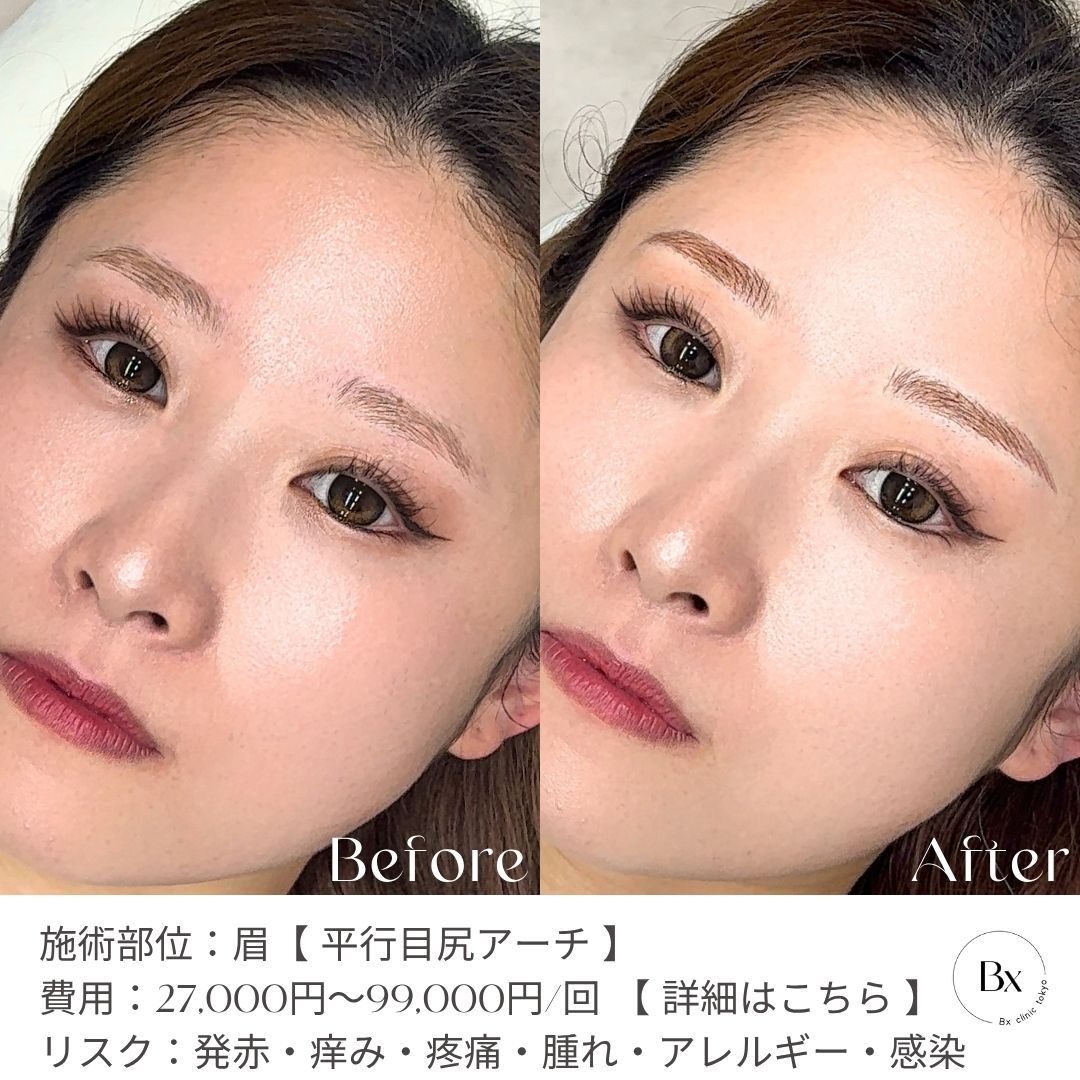 multi_image