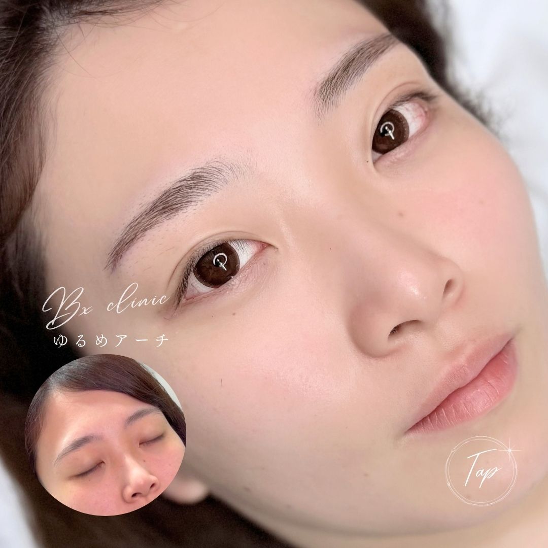 multi_image